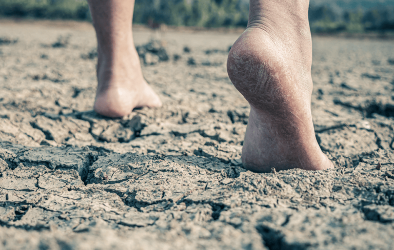 Foot Care in Dry Climates – Sheehy Ankle + Foot Center